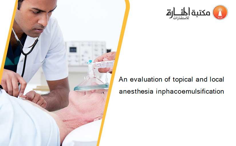 An evaluation of topical and local anesthesia inphacoemulsification