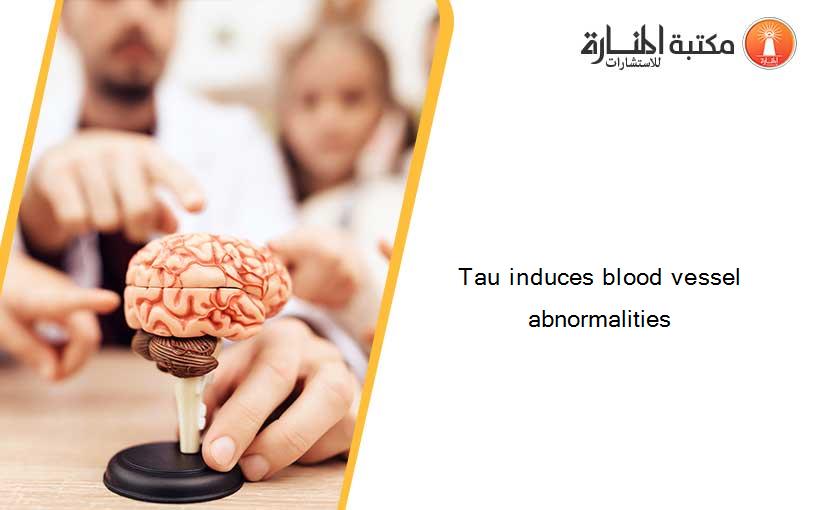 Tau induces blood vessel abnormalities
