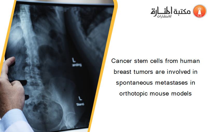 Cancer stem cells from human breast tumors are involved in spontaneous metastases in orthotopic mouse models