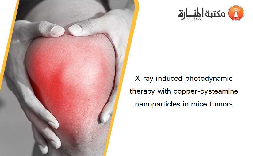 X-ray induced photodynamic therapy with copper-cysteamine nanoparticles in mice tumors