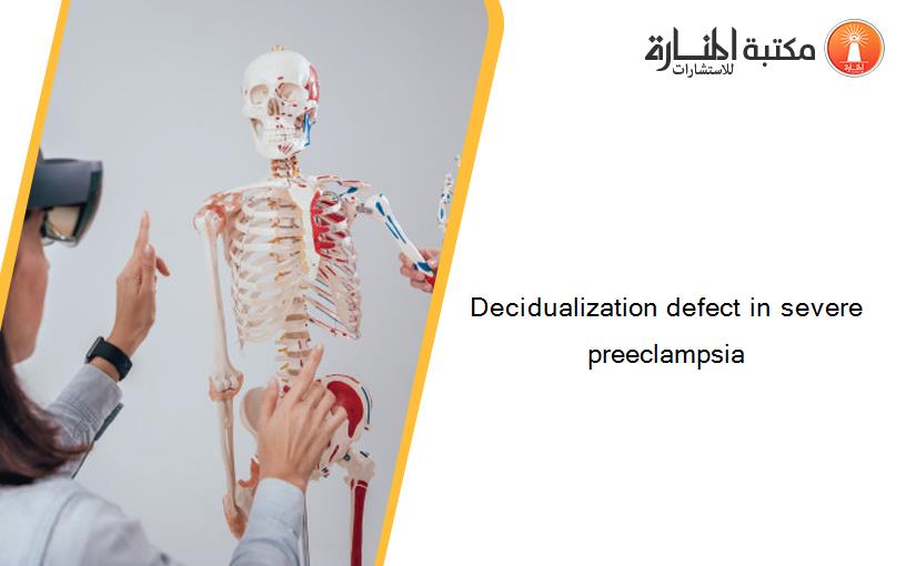 Decidualization defect in severe preeclampsia
