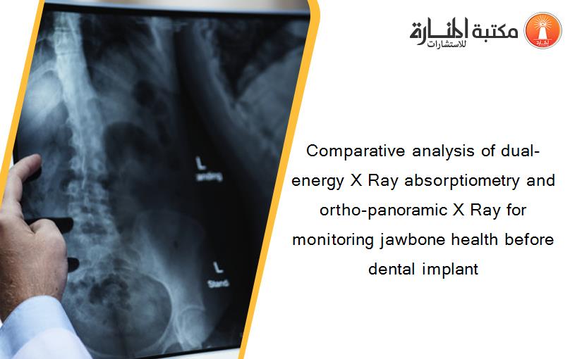 Comparative analysis of dual-energy X Ray absorptiometry and ortho-panoramic X Ray for monitoring jawbone health before dental implant
