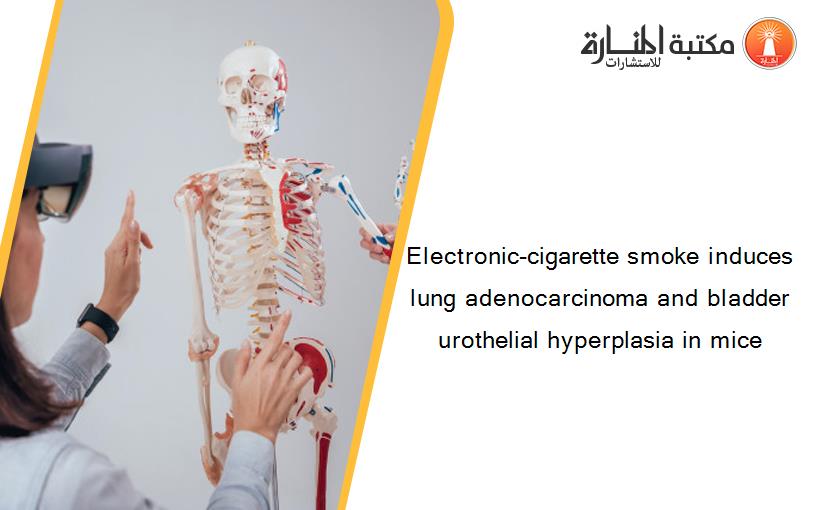 Electronic-cigarette smoke induces lung adenocarcinoma and bladder urothelial hyperplasia in mice