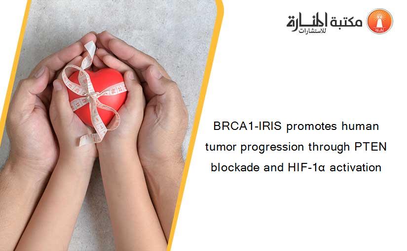 BRCA1-IRIS promotes human tumor progression through PTEN blockade and HIF-1α activation