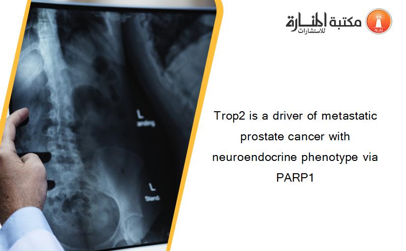 Trop2 is a driver of metastatic prostate cancer with neuroendocrine phenotype via PARP1