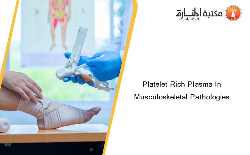 Platelet Rich Plasma In Musculoskeletal Pathologies