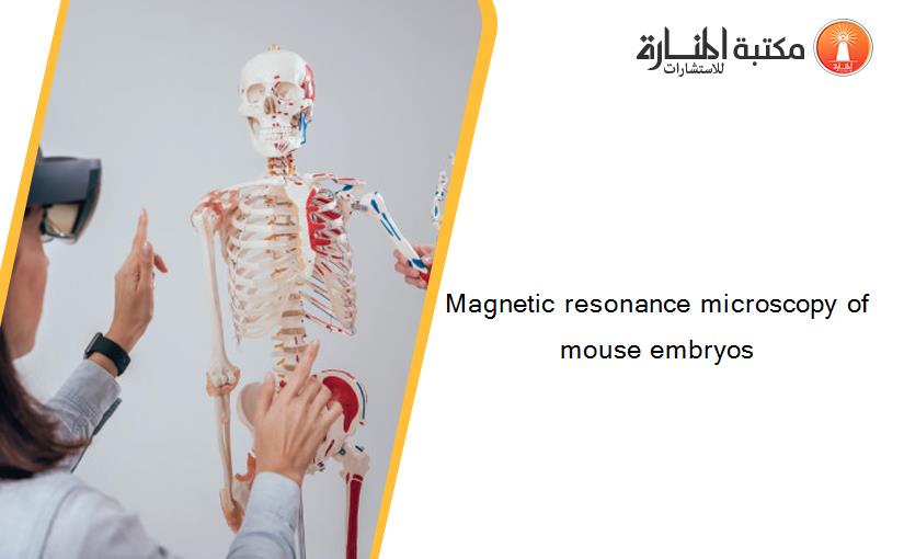 Magnetic resonance microscopy of mouse embryos