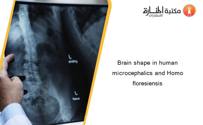 Brain shape in human microcephalics and Homo floresiensis