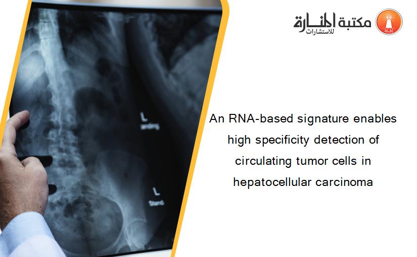 An RNA-based signature enables high specificity detection of circulating tumor cells in hepatocellular carcinoma