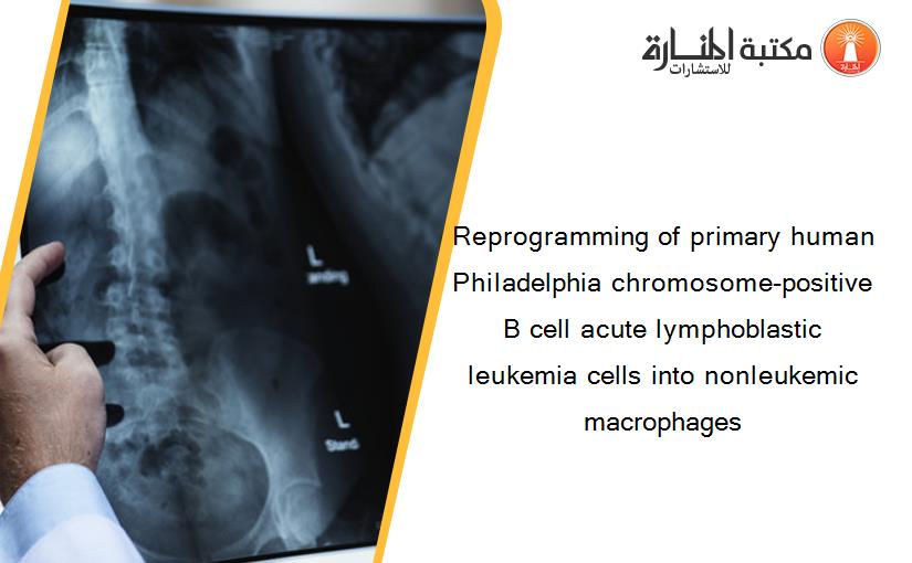 Reprogramming of primary human Philadelphia chromosome-positive B cell acute lymphoblastic leukemia cells into nonleukemic macrophages